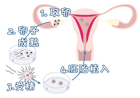 有偿志愿者供卵代孕怎么找